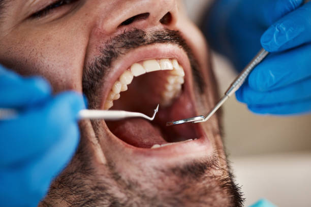 Best Broken or Cracked Tooth Emergency Dentist in Guthrie, KY